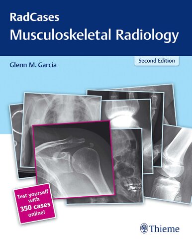 Radcases Musculoskeletal Radiology