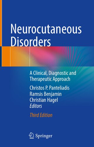 Neurocutaneous Disorders: A Clinical, Diagnostic and Therapeutic Approach