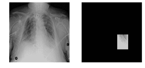 Kaggle Kernel - rsna-pneumonia-detection-challenge - Page8