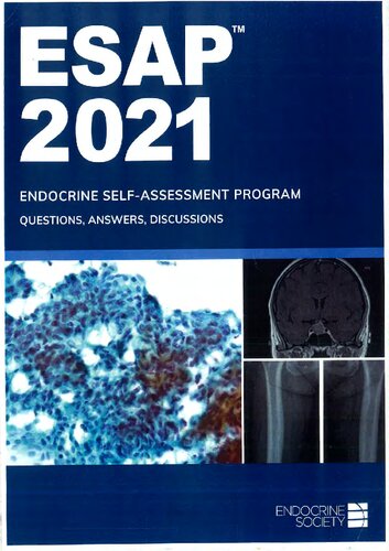 ESAP™ 2021 Endocrine Self-Assessment Program Questions&Answers Discussions Endocrine Society