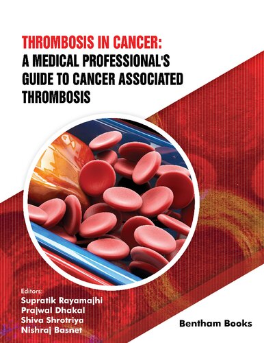 Thrombosis in Cancer: A Medical Professional`s Guide to Cancer Associated Thrombosis