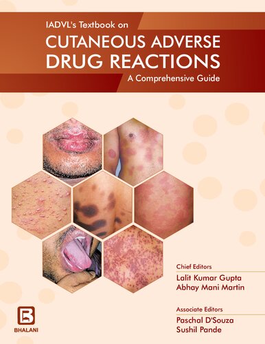 IADVL textbook on cutaneous adverse drug reactions