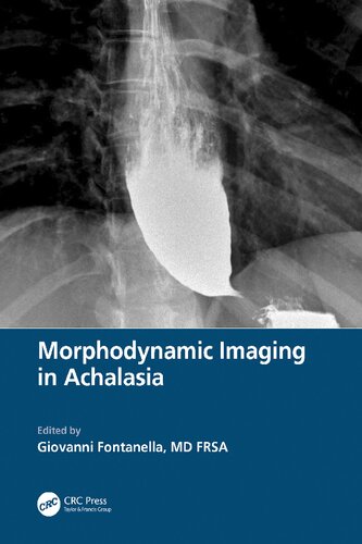 Morphodynamic Imaging in Achalasia