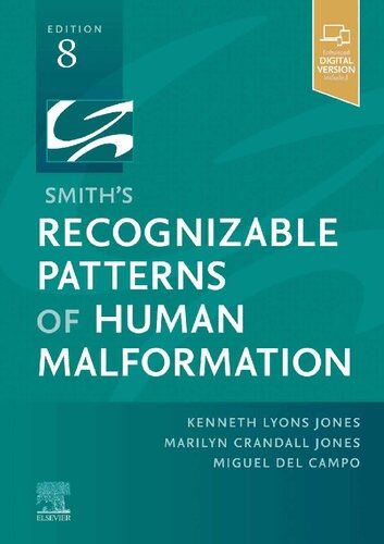 Smith's Recognizable Patterns of Human Malformation