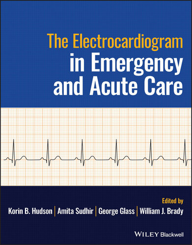 The Electrocardiogram in Emergency and Acute Care