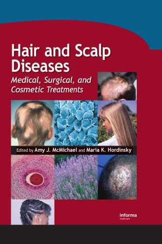 Hair and Scalp Diseases: Medical, Surgical, and Cosmetic Treatments