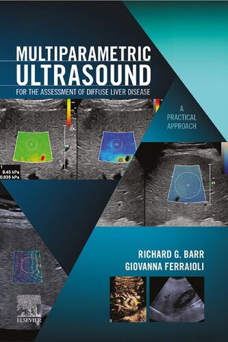 Multiparametric Ultrasound for the Assessment of Diffuse Liver Disease: A Practical Approach