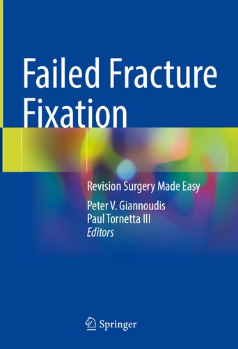 Failed Fracture Fixation: Revision Surgery Made Easy