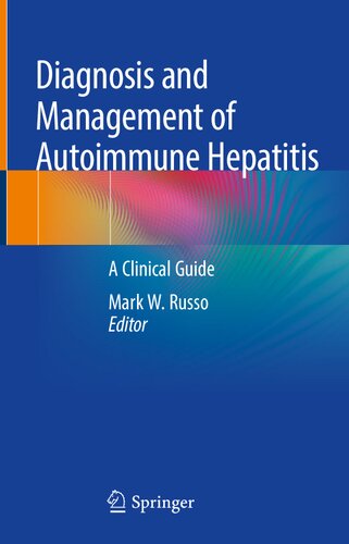 Diagnosis and Management of Autoimmune Hepatitis: A Clinical Guide