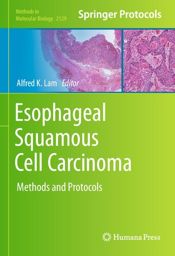 Esophageal Squamous Cell Carcinoma: Methods and Protocols (Methods in Molecular Biology, 2129)