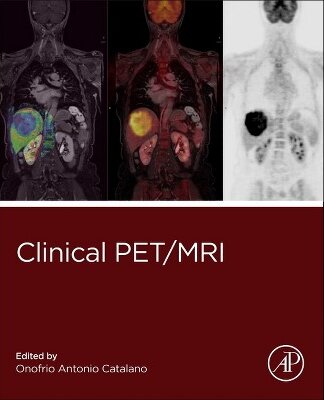 Clinical PET / MRI - Radiology Molecular Imaging