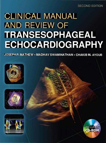 Clinical Manual and Review of Transesophageal Echocardiography