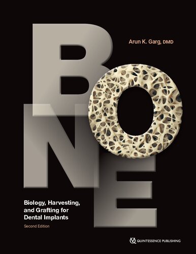 Bone: Biology, Harvesting, and Grafting for Dental Implants