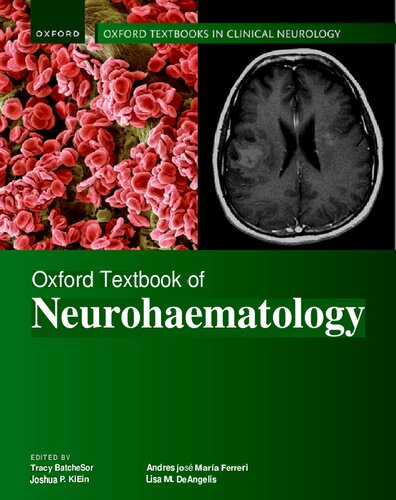 Oxford Textbook of Neurohaematology (Oxford Textbooks in Clinical Neurology) (Aug 7, 2024)_(0198884907)_(Oxford University Press).pdf