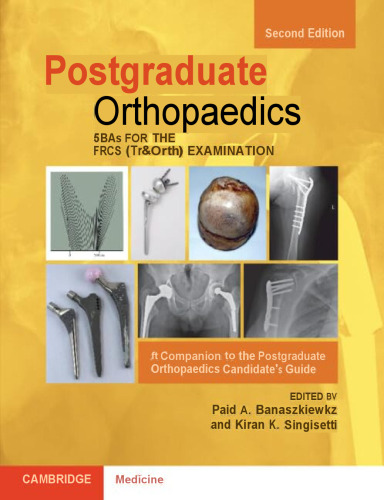 SBAs for the FRCS (Tr&Orth) Examination - A Companion to the Postgraduate Orthopaedics Candidate's Guide, 2e (Jan 31, 2025)_(1009287923)_(Cambridge University Press).pdf