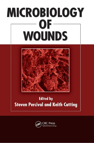 Microbiology of Wounds