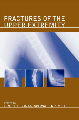 Fractures of the Upper Extremity