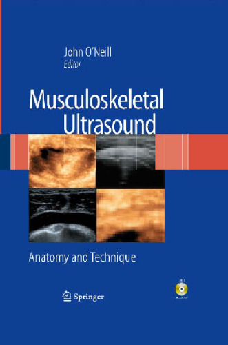 Musculoskeletal Ultrasound: Anatomy and Technique