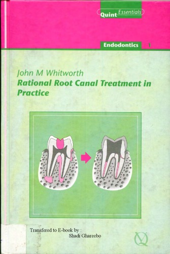 Rational Root Canal Treatment in Practice (Quintessentials of Dental Practice)