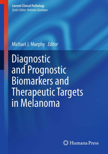 Diagnostic and Prognostic Biomarkers and Therapeutic Targets in Melanoma