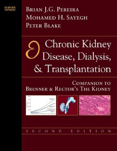 Chronic kidney disease, dialysis, and transplantation : a companion to Brenner and Rector's the kidney