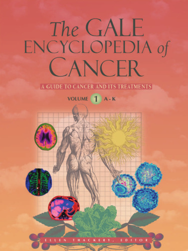 The Gale encyclopedia of cancer : a guide to cancer and its treatment